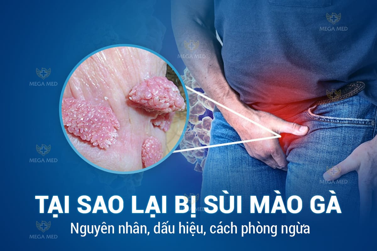 Tại sao lại bị sùi mào gà